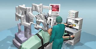 Image result for Robotic Partial Nephrectomy Video Animation