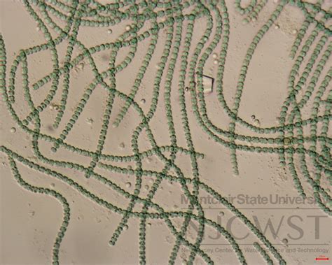 Anabaena Under Microscope 400x