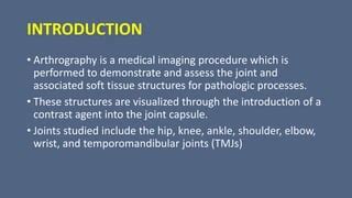 Image result for Arthogram Explained