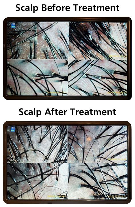 Japanese Head Spa Massage | My Haven Laser & Spa SW Calgary