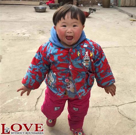 Asian Person With Down Syndrome
