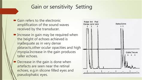 Image result for Biometry Procedure