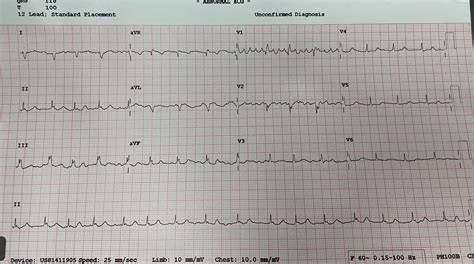 78F post dialysis with sudden SOB : r/EKGs