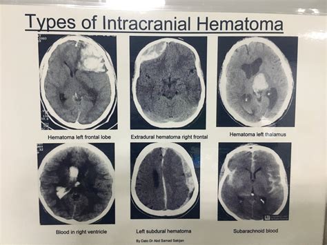 Different Types Of Scans