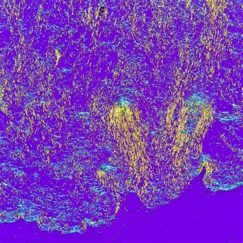 Body Fluid Crystals: Identification and Clinical Significance