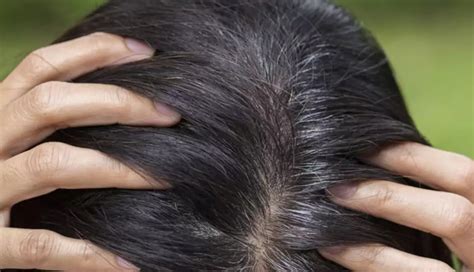 5 Natural Ways You Can Darken Grey Hair at Home - lifeberrys.com