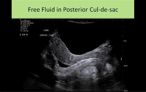 Pelvic Sonography | Ultrasound, Sonography, Diagnostic medical sonography