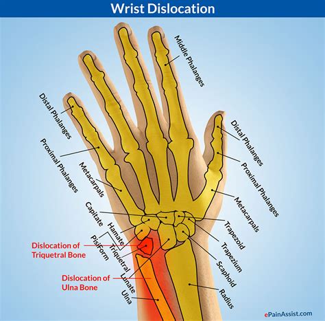 Anatomy Of Wrist