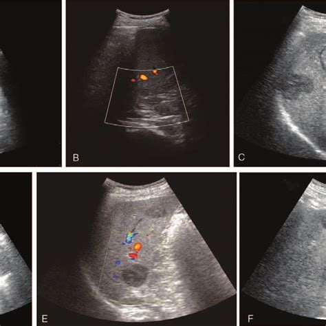 Image result for Ultrasound Lab