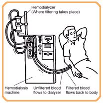 Diabetes India - Don't "Kid" Around With Your Kidneys
