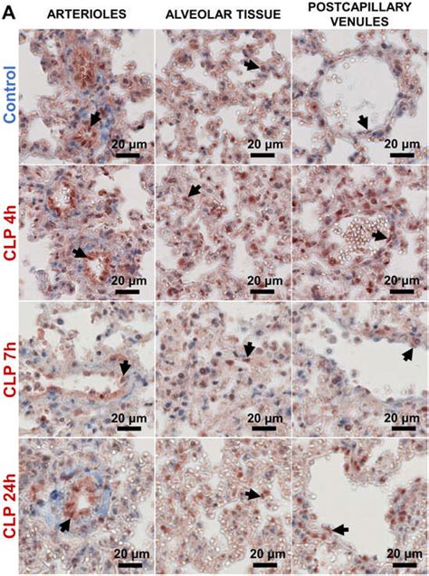 Heterogeneous Patterns of Endothelial NF-κB p65 and MAPK c-Jun ...