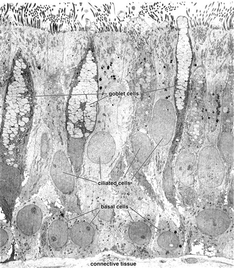 Image result for Visual Growing Patterns