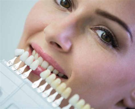 Yellow Teeth Causes And Best Home Remedies For Cleaning Yellow Teeth ...