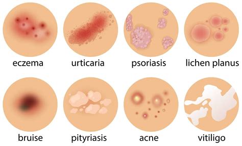 How to Stop Itchy Feet: 9 Best & Natural Relief