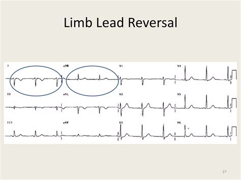 12 Lead EKG Interpretation ( PDFDrive ).pdf
