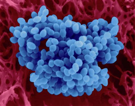 Image result for Enterococcus Faecalis Colon Cancer