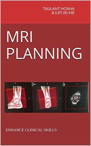 MRI PLANNING: ENHANCE CLINICAL SKILLS eBook : Hoxha B.S RT (R) MR ...