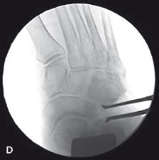 Hardware Monitor Driver 的图像结果