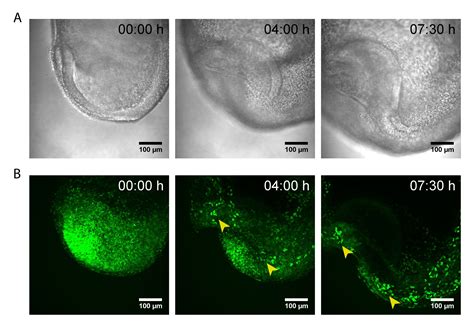 Image result for Mouse Embryo Heart Development