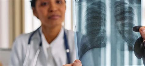 La importancia del signo de la silueta para interpretación de la ...