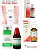 Homeopathy Varicose Veins Treatment Kit- Calc Fluor, Hamamelis, R42 ...