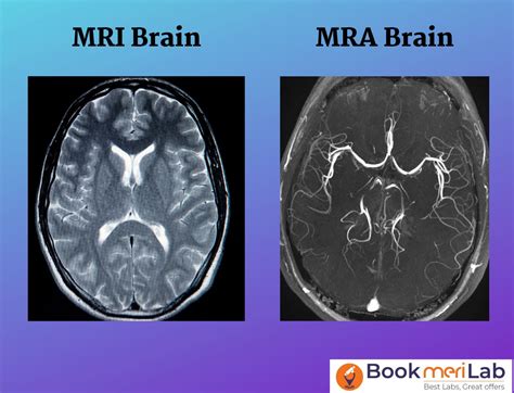 What Is A Mri And Mra at William Woodard blog