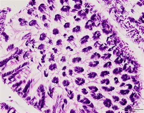 Image result for Tissue Sample Drawing Under Microscope