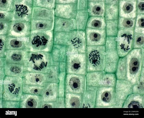 Plant cell mitosis. Light micrograph of root tip cells from an onion ...