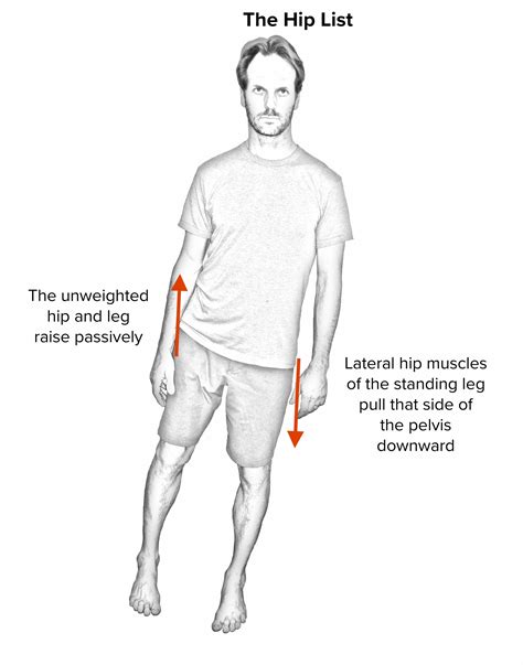 Image result for Hip Leveling Guide