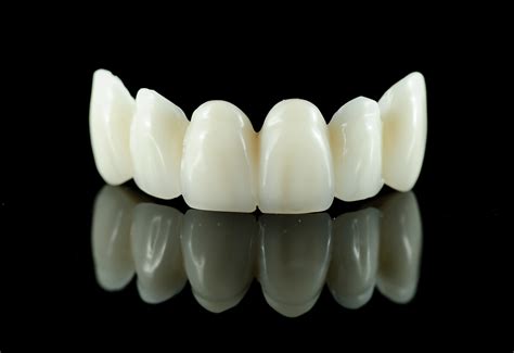 What Are Zirconia Veneers at Sherlyn Weyer blog