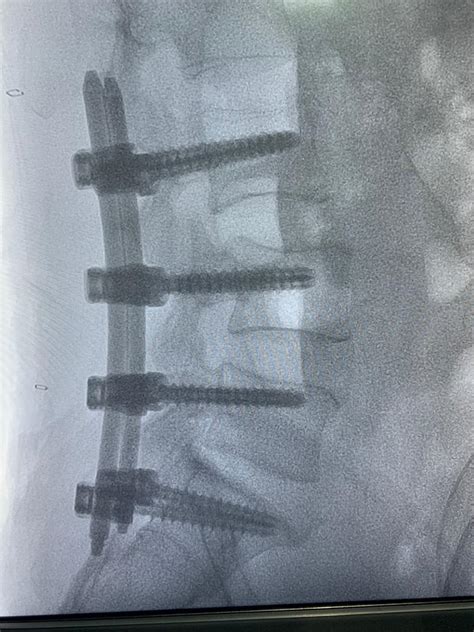 International Neurosurgery Hospital Rankings: Dr. Rao's