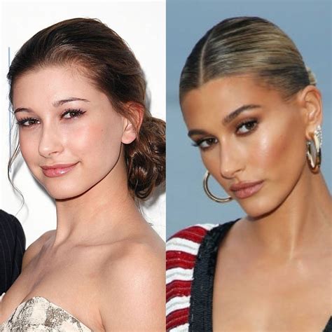 Justin and Hailey Bieber threaten to sue cosmetic surgeon - NZ Herald