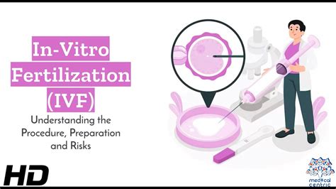 IVF Procedure Explained 的图像结果