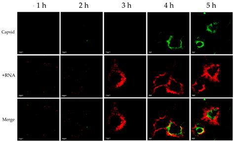 Detection of Viral −RNA and +RNA Strands in Enterovirus-Infected Cells ...