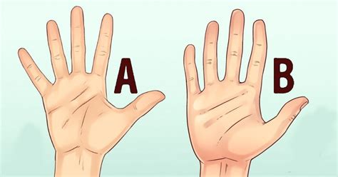 Image result for Genetics in Hand Shape