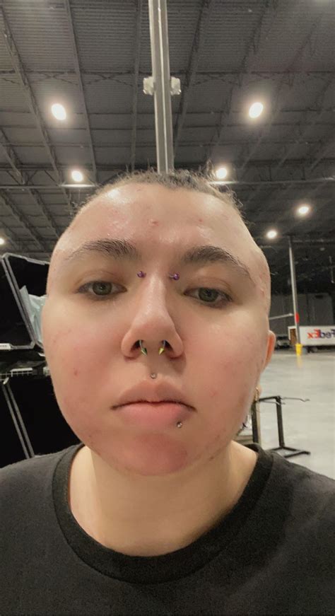 Angel bites or shark bites? I am redoing my other snakebite as well ...