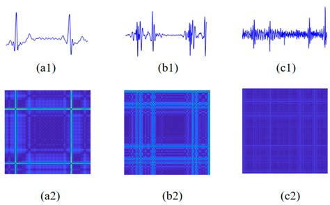 Coronary Artery Disease Detection Based on a Novel Multi-Modal Deep ...