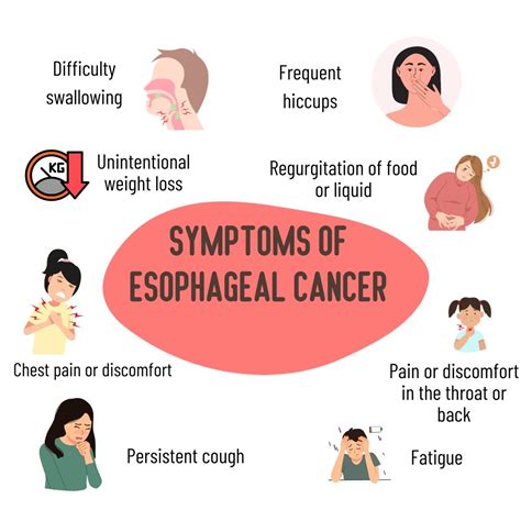 Esophageal Cancer: Causes, Risk Factors, Symptoms, Treatment