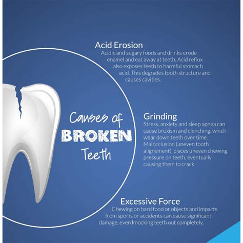 Broken Tooth Pain Relief: Expert Tips for Managing Pain - Smile Studio Boston
