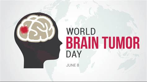 World Brain Tumor Day 2023: ब्रेन ट्यूमर के लिए हर बार नहीं होती ऑपरेशन ...