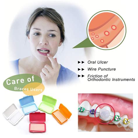 BRMDT Braces Wax 10Pcs - Moldable Orthodontic Wax for Retainers ...