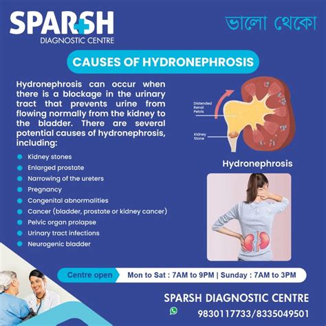 Causes Of Hydronephrosis