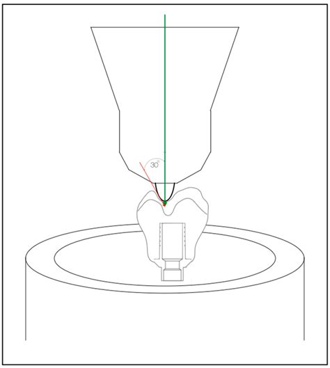 Fatigue Loading Test on Screw-Retained Lithium Disilicate Crowns ...