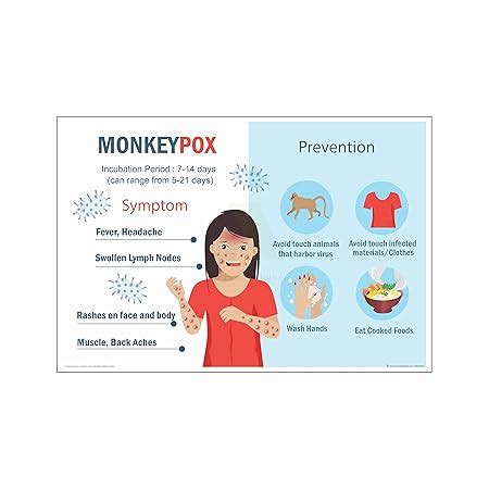 Anne Print Solutions® Monkeypox prevention chart Posters For Hospital ...