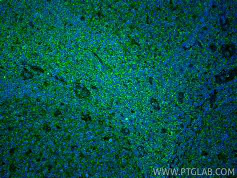 CXCR3B-specific antibody (60065-1-PBS) | Proteintech