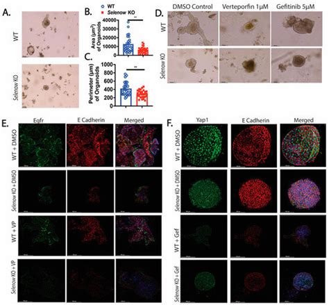 Selenoprotein W Ameliorates Experimental Colitis and Promotes ...