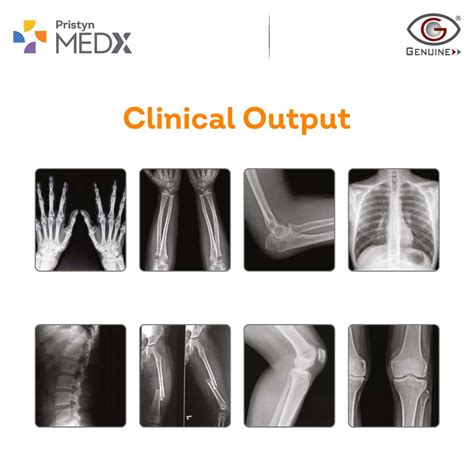 Image result for Realx Ray Machine