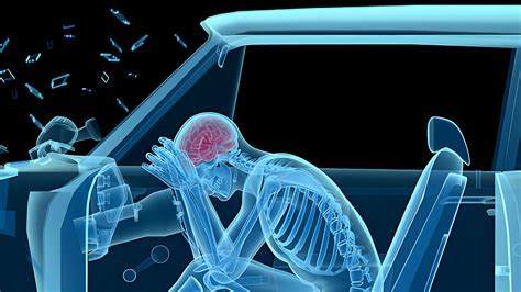 Head Injury Road Accident