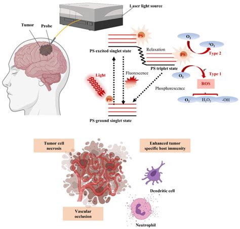 Nanomedicine in Clinical Photodynamic Therapy for the Treatment of ...