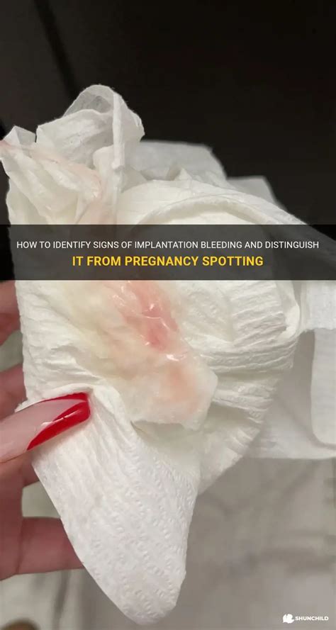 How To Identify Signs Of Implantation Bleeding And Distinguish It From ...